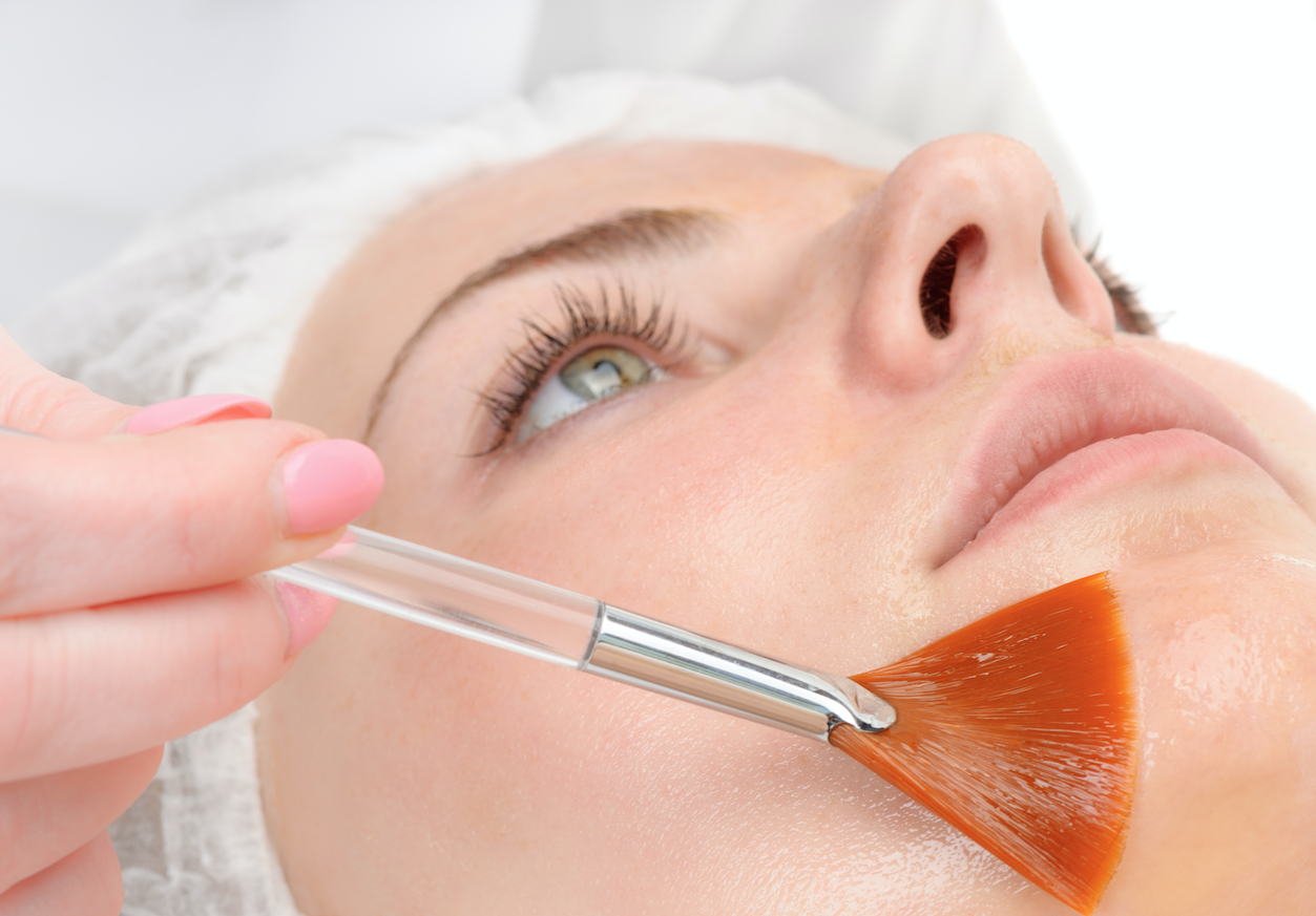 Lactic acid peel